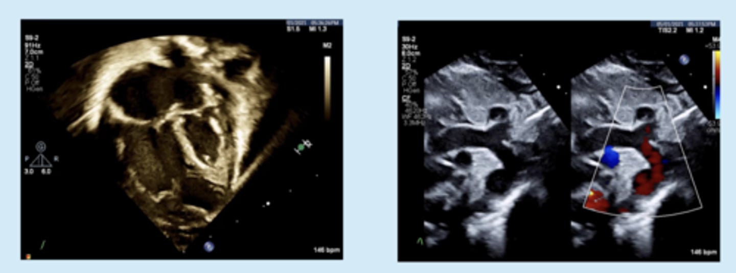 <p>bright spot on pic - under MV</p>