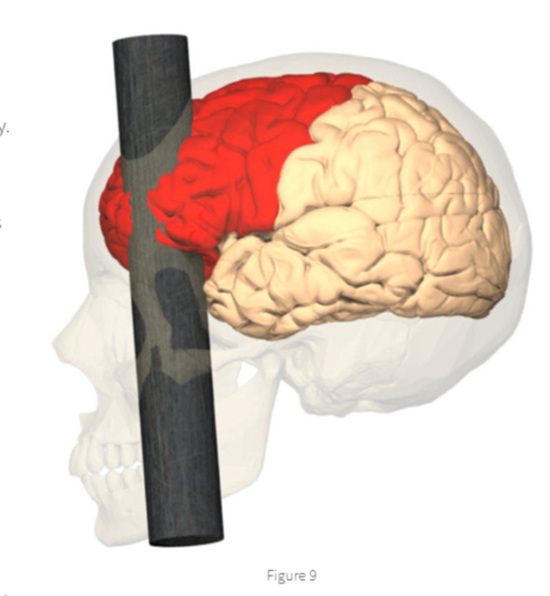 <p>who is this? what damage sustained?</p><p>how behavior changed?</p>