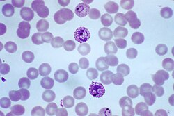 <p><strong>Phylum Apicomplexa (Sporozoans)</strong></p>