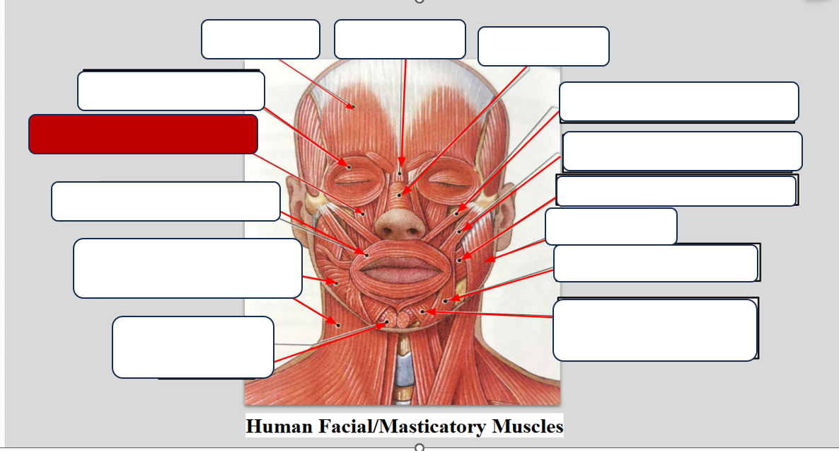 <p>Label the Muscle</p>