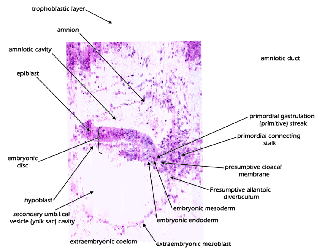 <p>Day 13-17 Embryo</p>