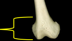 <p>The rounded end of a long bone that is involved in the formation of joints and growth plates. </p>