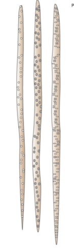 <p><strong>Tracheids</strong></p>