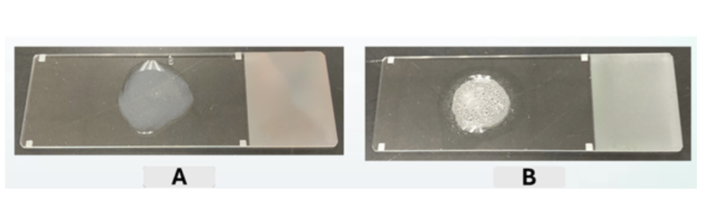 <p>Which sample is catalase positive?</p><ul><li><p>neither sample A nor sample B</p></li><li><p>both sample A and sample B</p></li><li><p>sample A only</p></li><li><p>sample B only</p></li></ul><p></p>