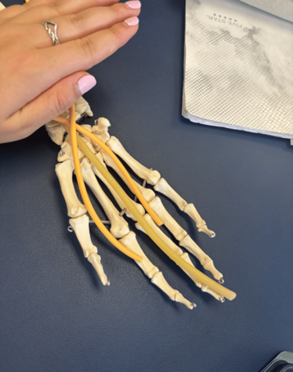 <p>What is this muscle?</p>