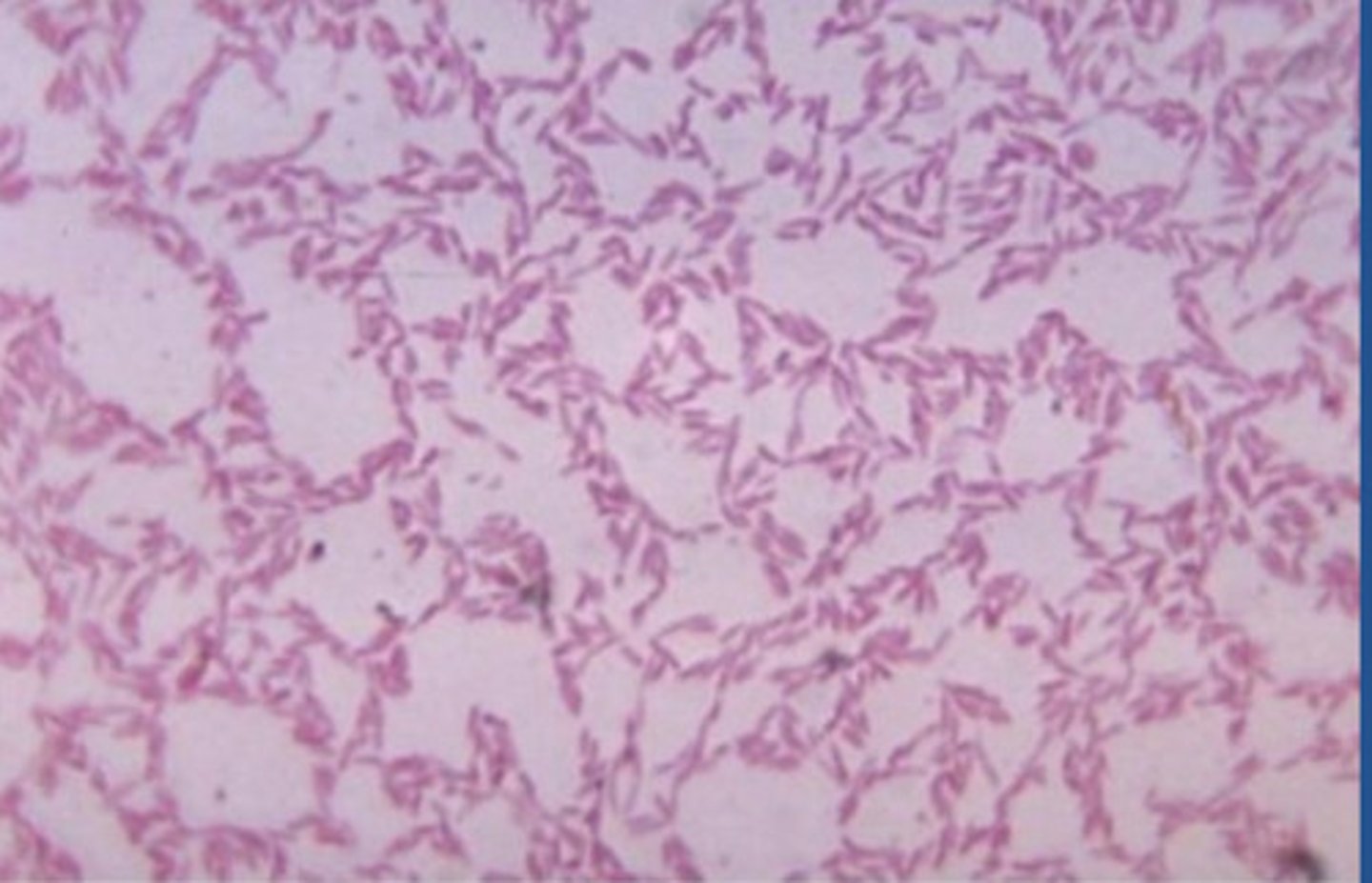 <p>includes photolithoautotrophs and chemoheterotrophs; found in gut and oral cavity; up to 30% of human feces</p>