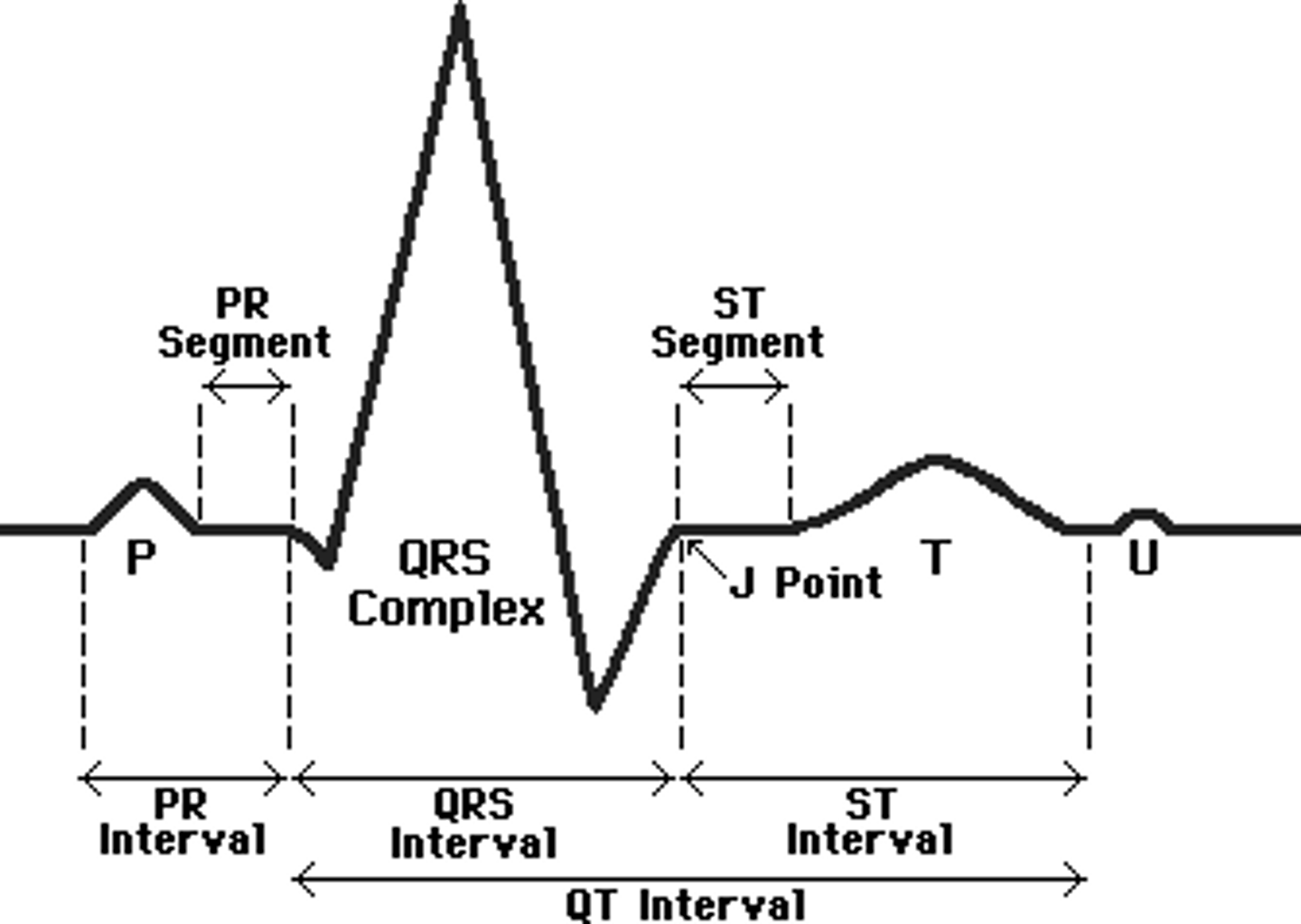 <p>time between ventricular depolarization and repolarization</p>