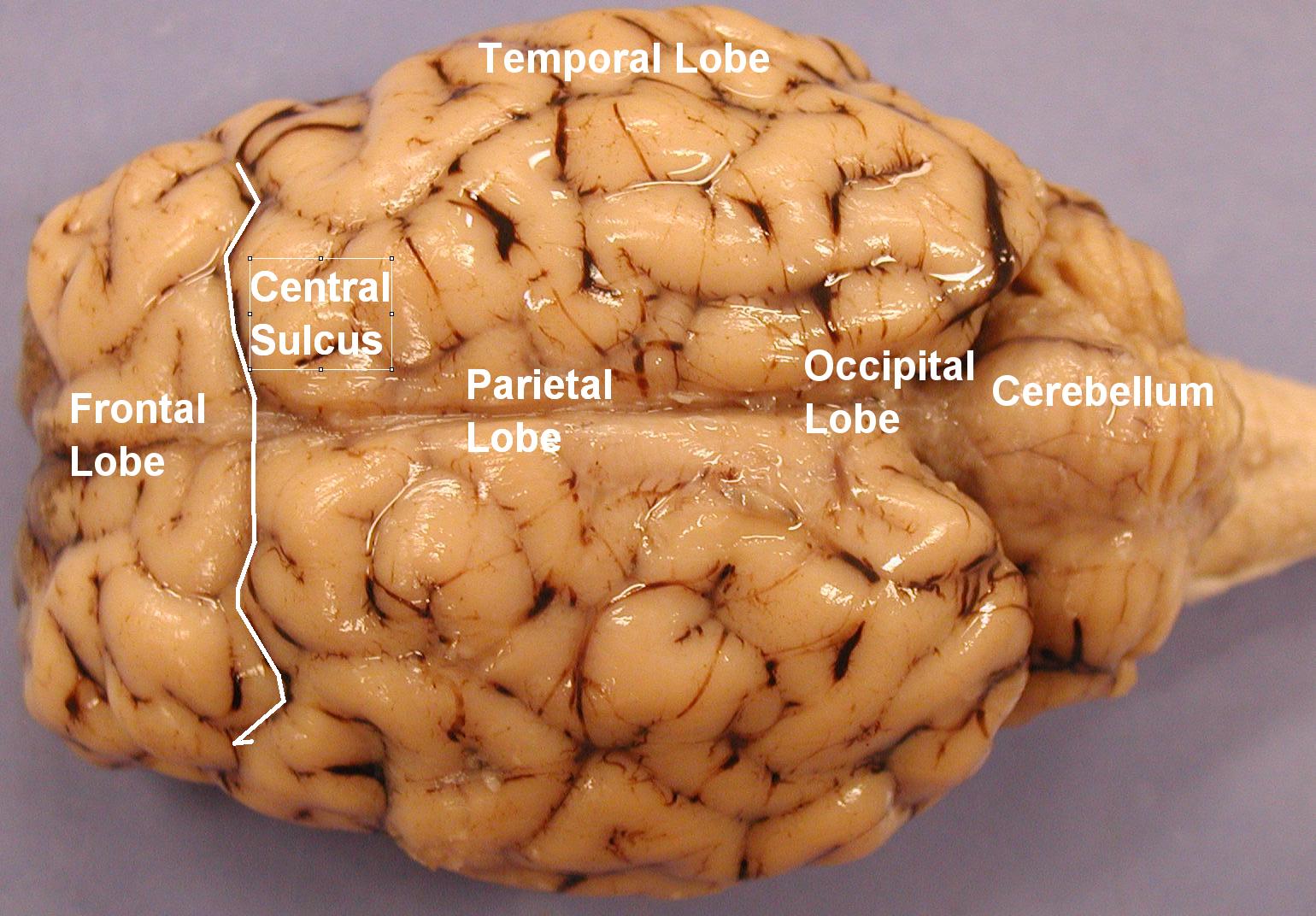 <p>Long groove in brain</p>