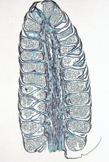 <p>Which structure is being shown?</p>