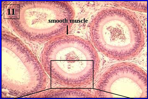 <p>Another view of the ductus epididymidis. </p><p>Note the abundance of circularly arranged smooth muscle surrounding the duct.</p>