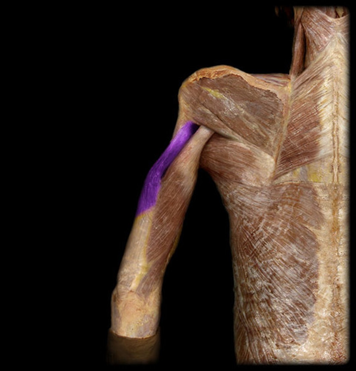 <p>Name the head of the triceps</p>