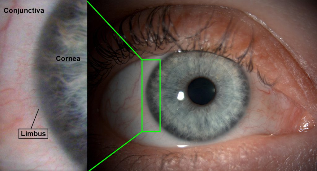 <p>forms a clear window that is the major light bending medium of the eye</p>