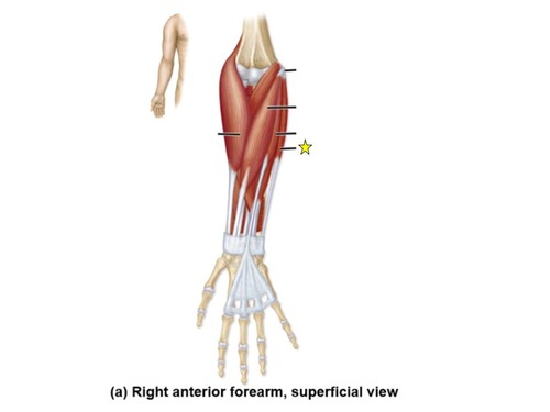 <p>identify the muscle</p>