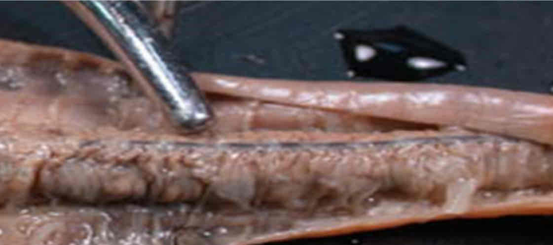 <p>Identify this structure</p>