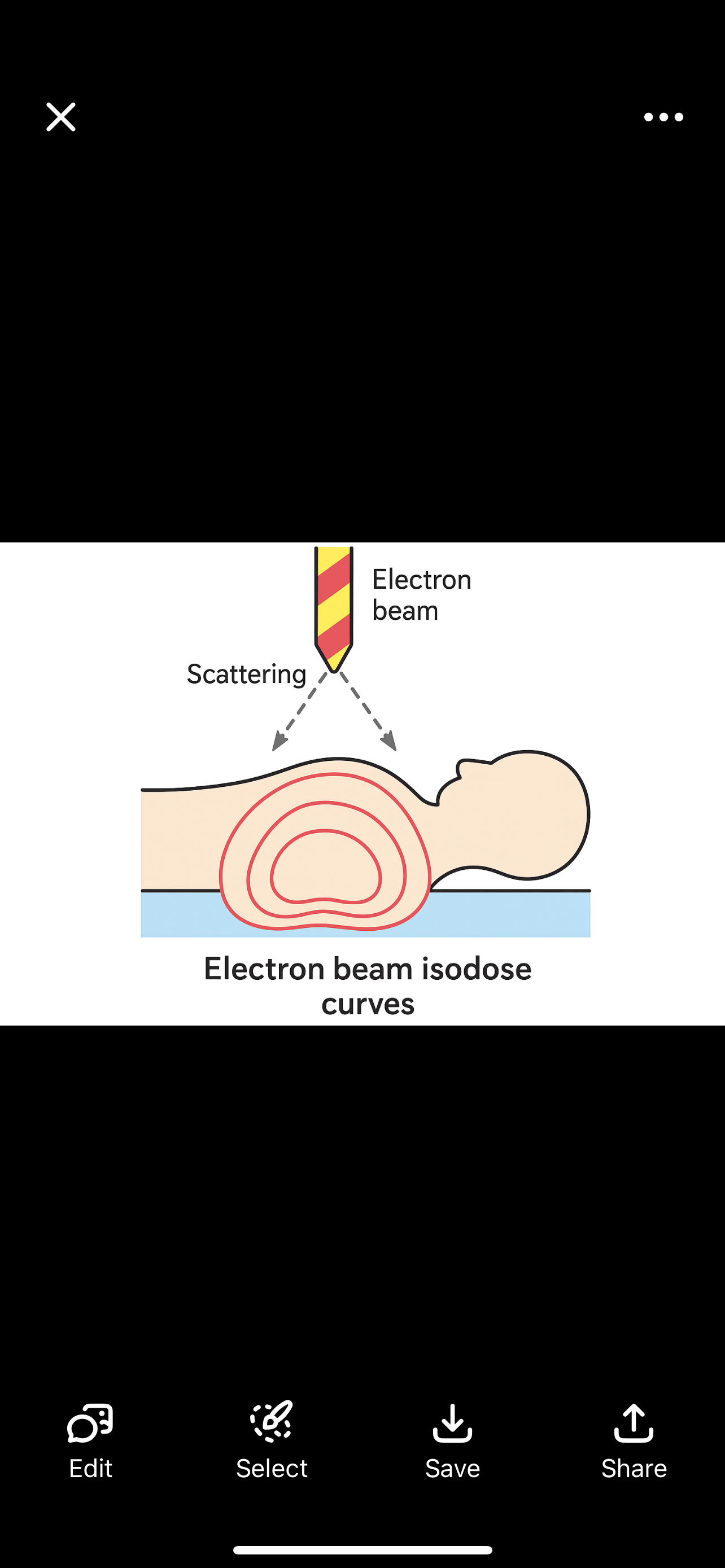 <p></p><p><strong><span>Electron Beam Isodose Curves</span></strong></p><p></p>