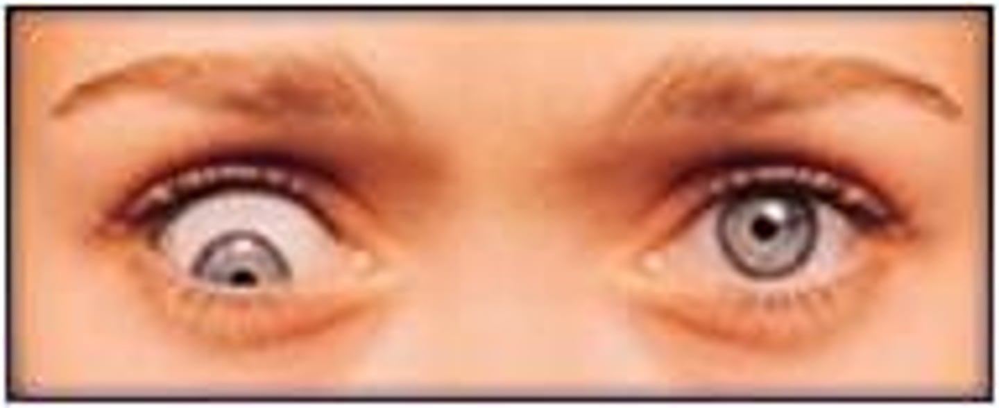 <p>eye turn down</p>