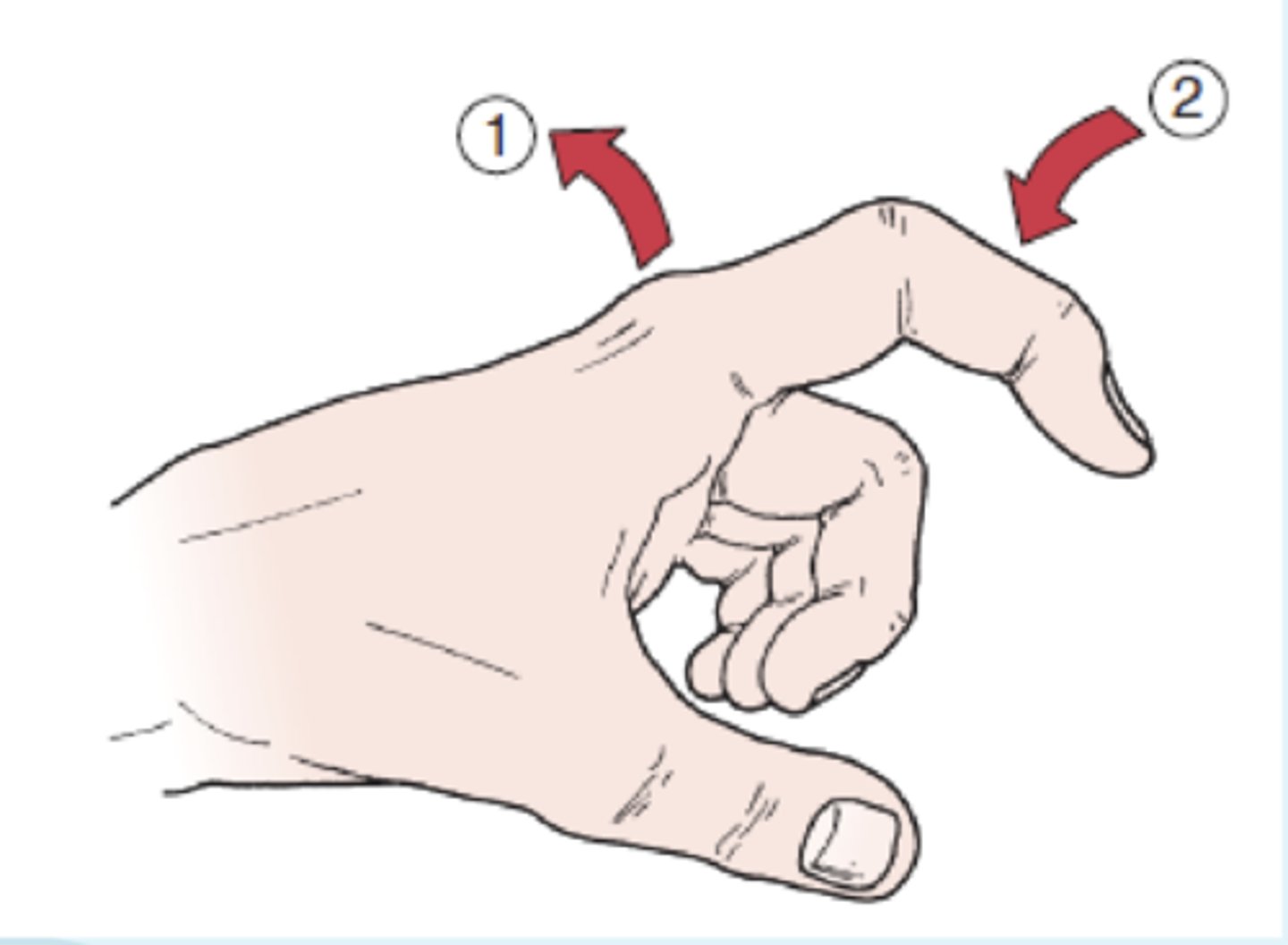 <p>- identifies tightness in structures surrounding the MCP joint</p><p>- description: the MCP joint is held slightly extended while the PT moves the proximal interphalangeal joint into flexion, if possible</p><p>(+): test is positive (which indicated by inability to flex the proximal interphalangeal joint), there is a tight intrinsic muscle or contracture of the joint capsule. if the metacarpophalangeal joints are slightly flexed, the proximal interphalangeal joint flexes fully if the intrinsic muscle are tight, but it does not flex fully if the capsule is tight. the pt remains passive during the test.</p>
