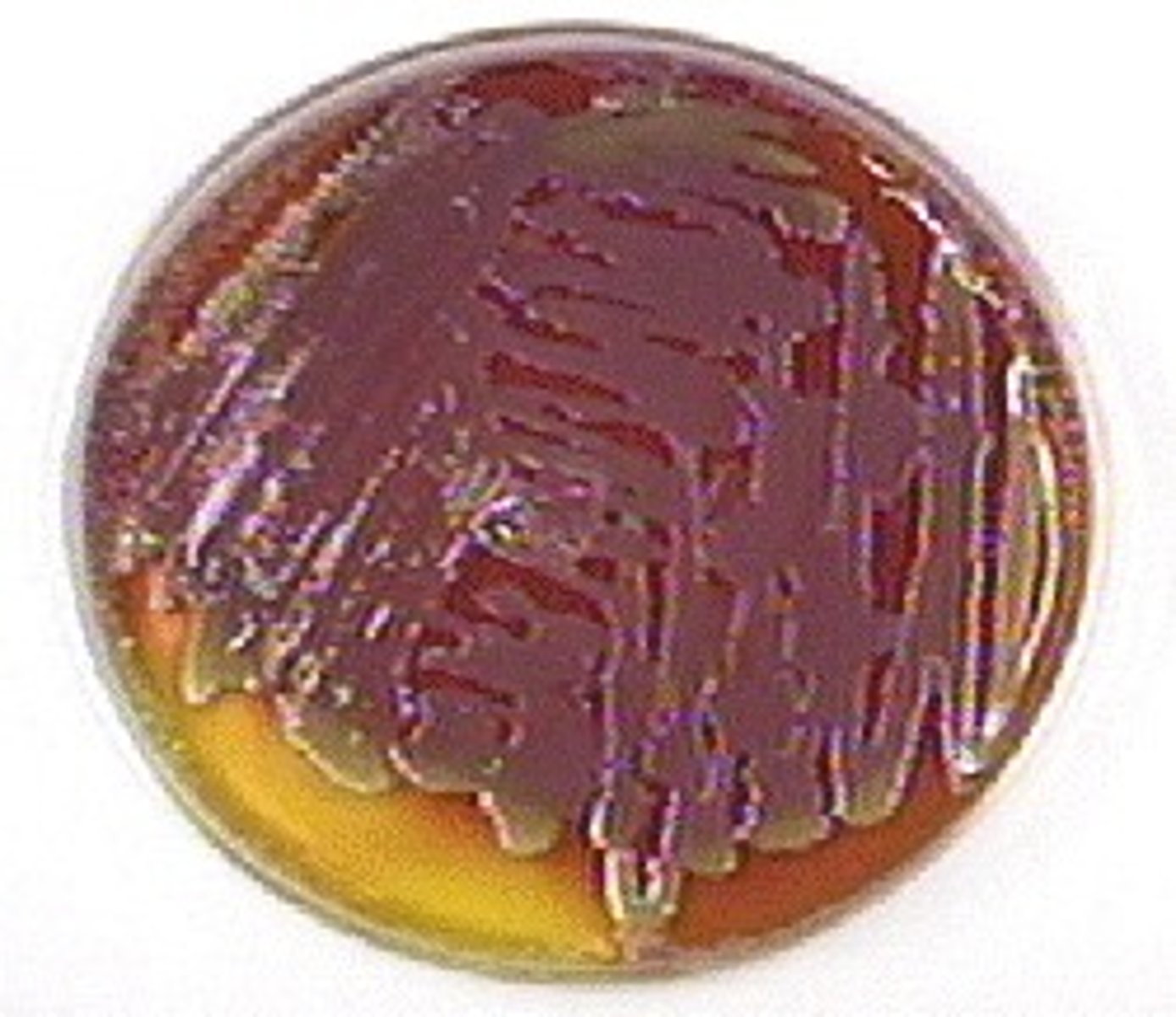 <p>Indole negative.</p><p>Hydrogen sulfide negative.</p><p>Sucrose positive.</p><p>V.P. Positive.</p>