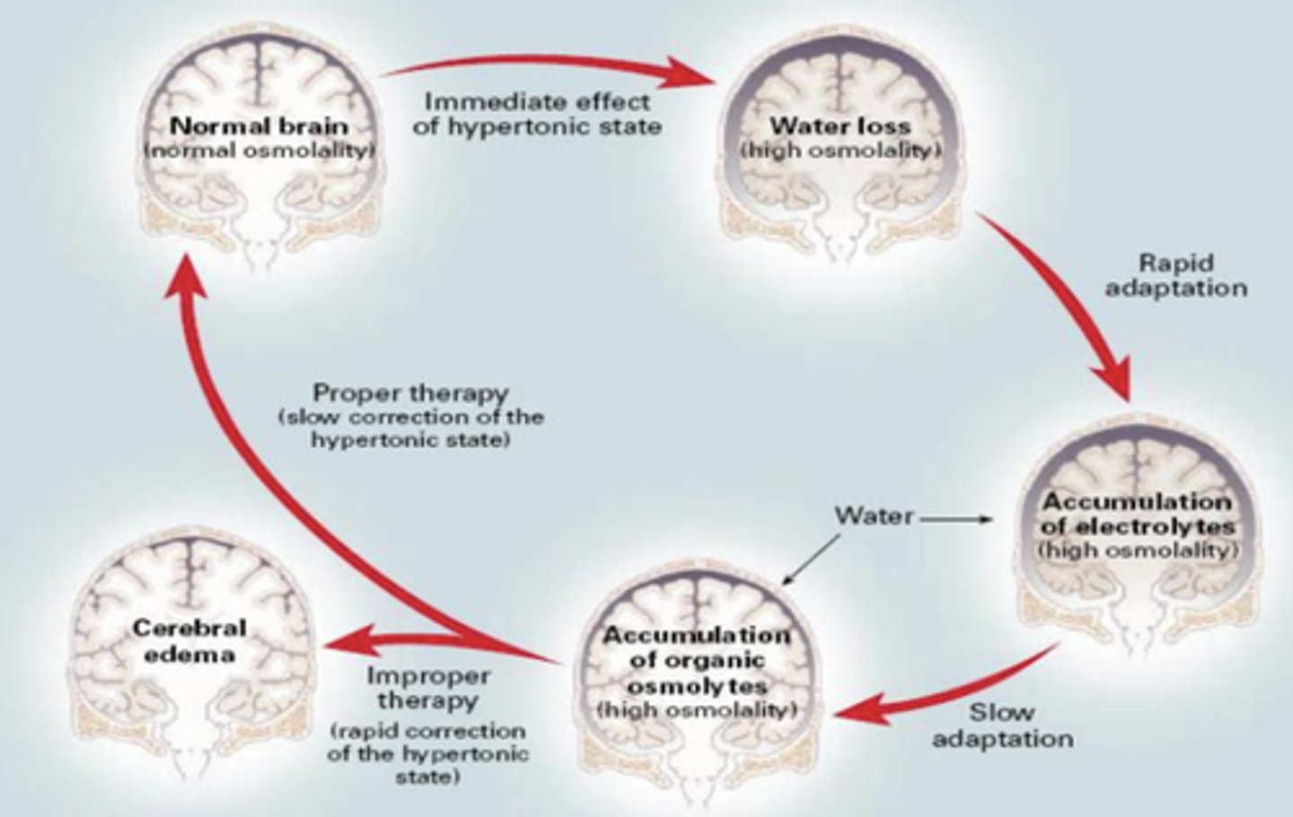 <p>plasma hyperosmolarity --> brain generates organic solutes to prevent water loss --> rapid correction of plasma osmolarity --> brain swelling</p>