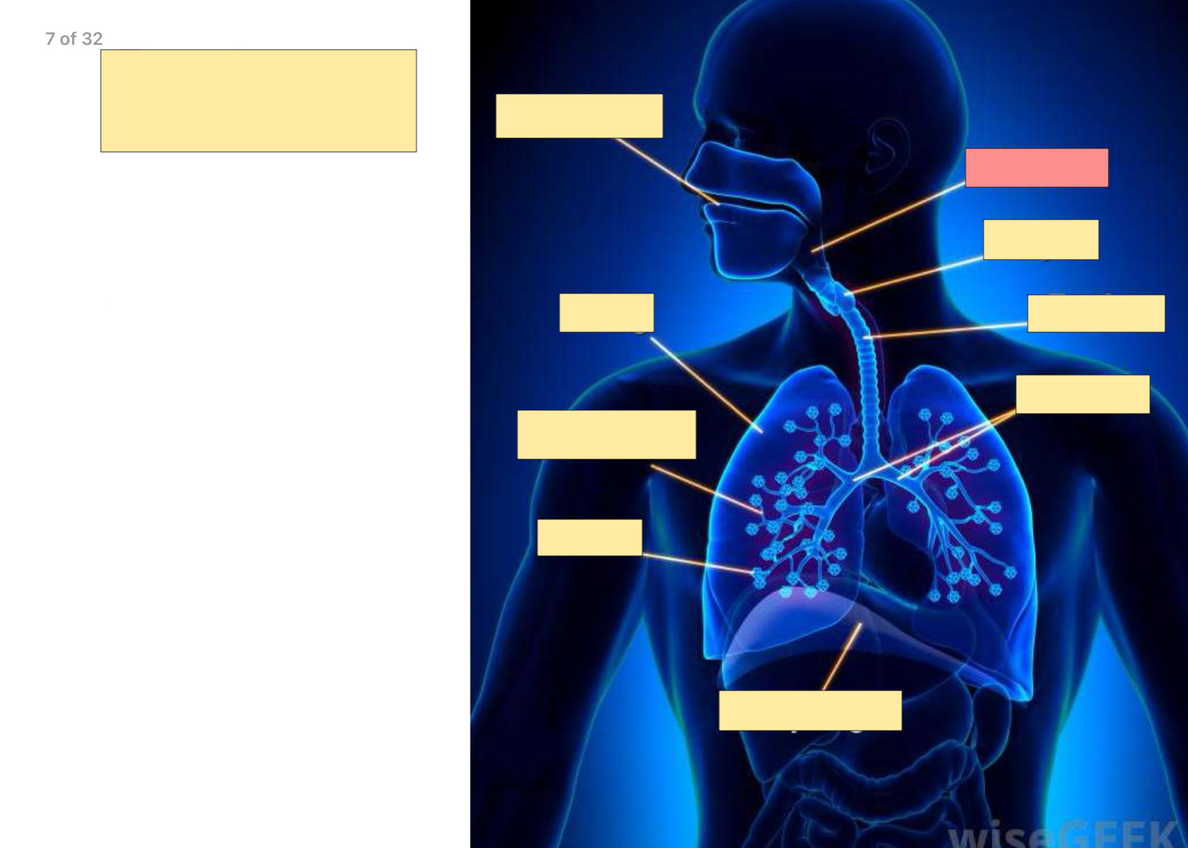 <p>What part of the esophagus is this?</p>