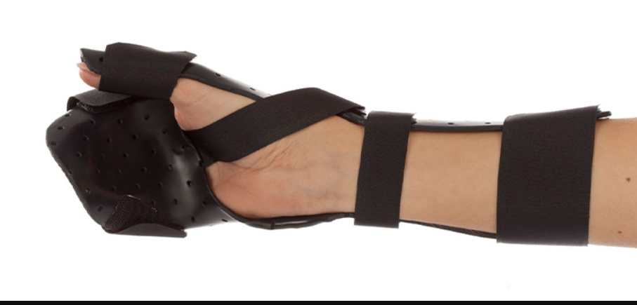 <ul><li><p>based on Rood’s inhibitory principles of sustained deep pressure</p></li><li><p>utilized to reduce flexor spasticity in hand</p></li></ul><p></p>