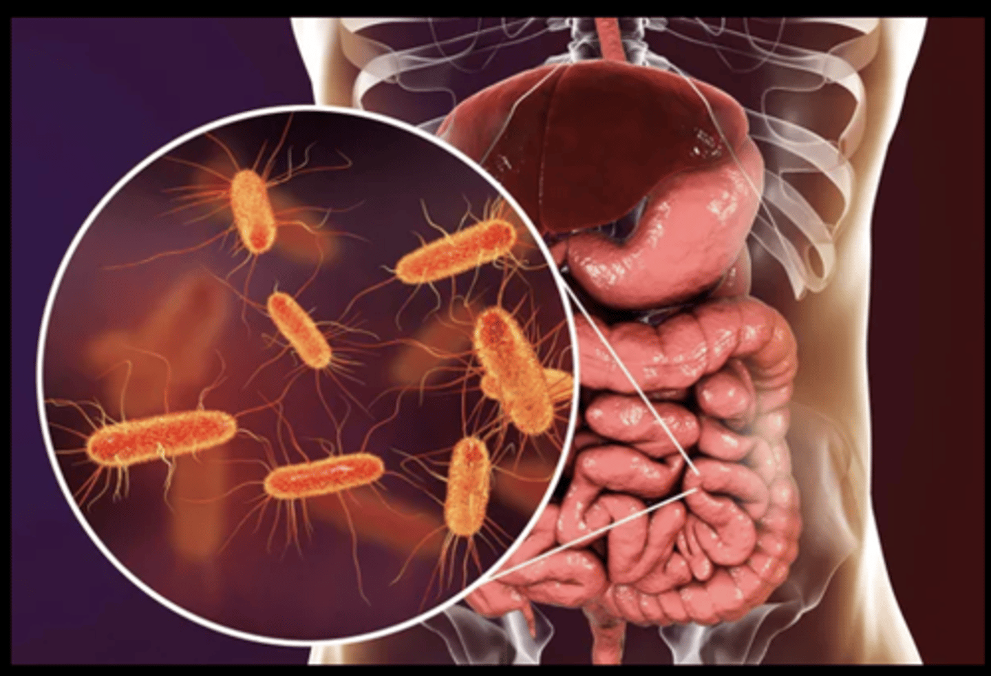 <p>In the study of 182 people, 12% of those who took Vowst had a recurrence during an 8-week period, compared to 40% of people who were given a placebo pill</p><p>Each capsule of Vowst contains live bacteria, which is taken from human fecal matter from screened donor</p><p>The Vowst dosing plan is four capsules taken orally once a day, for 3 days in a row</p>