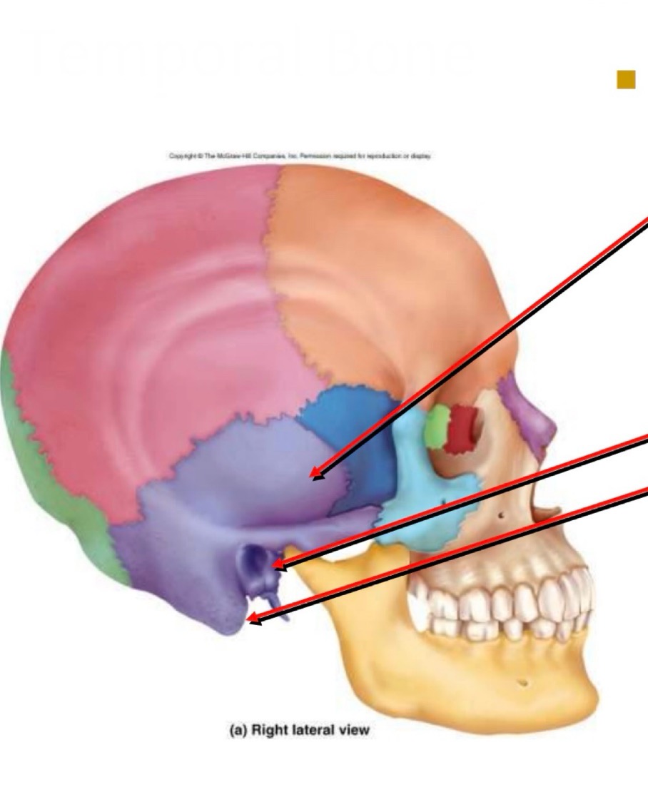 <p>What bone is this?</p>