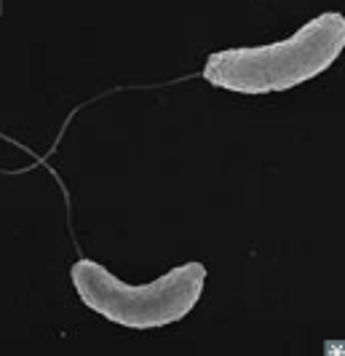 <p>An acute intestinal infection caused by ingestion of bacteria contaminated water or food</p>