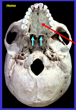 <p>What is the red arrow?</p>