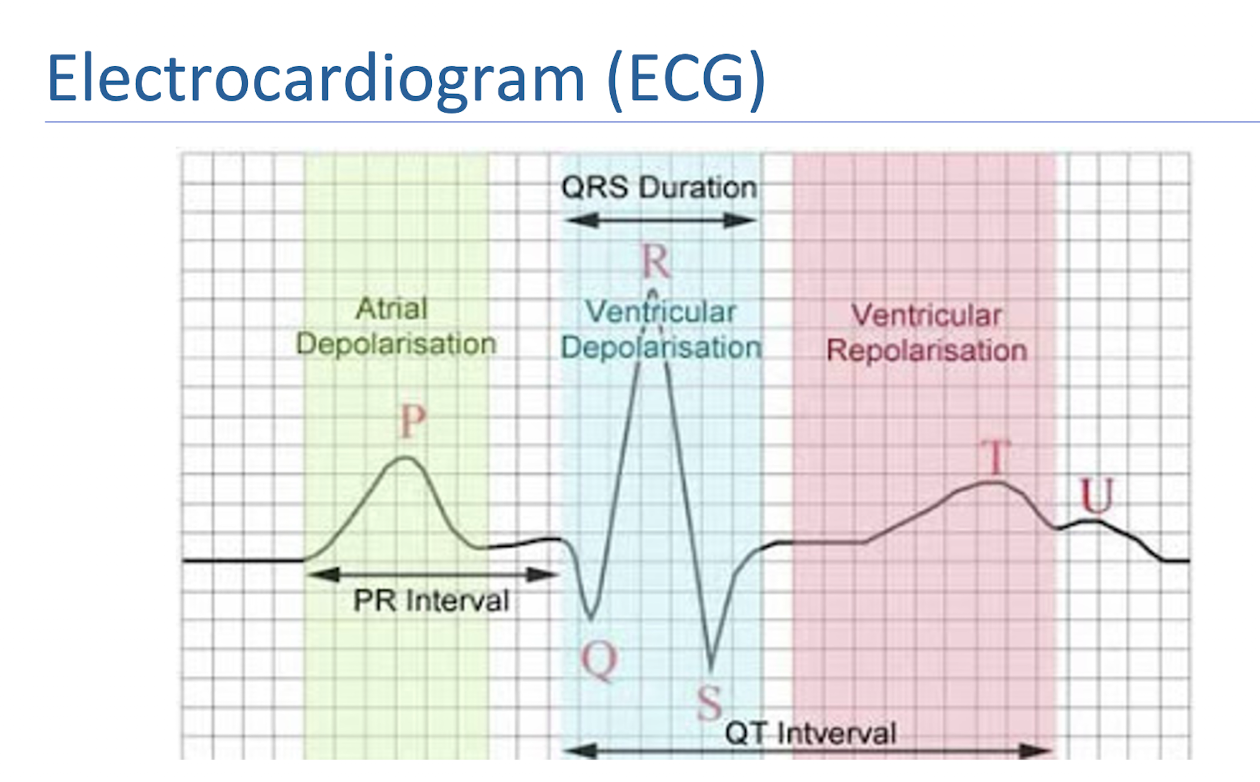<ul><li><p>What is it?</p><ul><li><p>Records the electrical activity of the heart</p></li></ul></li><li><p>P Wave:</p><ul><li><p>Atrial Depolarization</p></li></ul></li><li><p>QRS Complex:</p><ul><li><p>Ventricular Depolarization and Atrial Repolarizarion</p></li></ul></li><li><p>T Wave:</p><ul><li><p>Ventricular Repolarization</p></li></ul></li></ul><p></p>