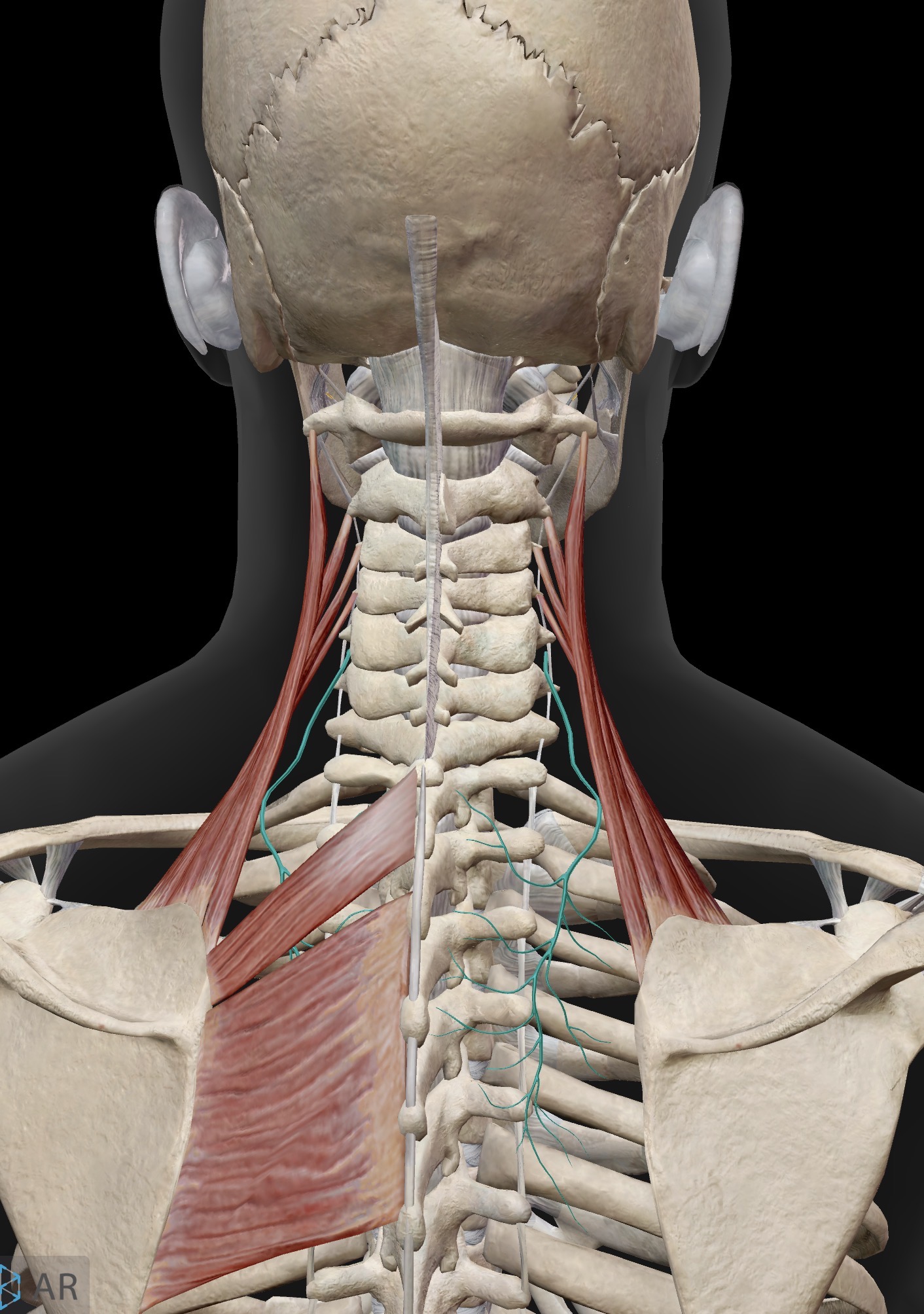 <p>What nerve is this? What does it innervate in the pectoral girdle?</p>