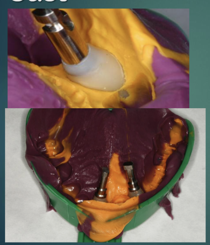 <ul><li><p>re-position provisional restoration in VPS impression </p></li><li><p>make sure it fits correctly </p></li><li><p>pour impression using die stone/yellow stone </p></li></ul><p></p>