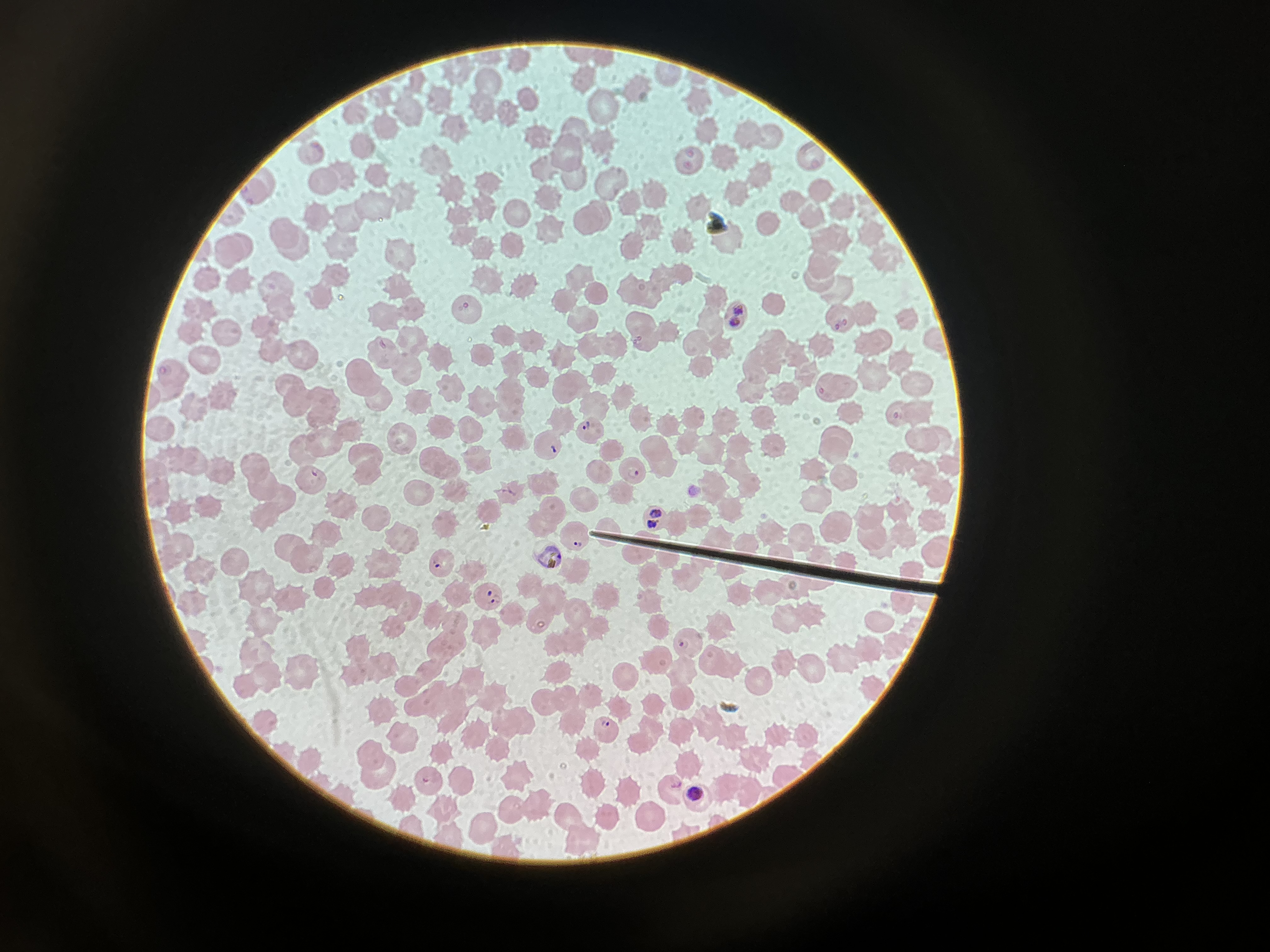 <p>Plasmodium sp.</p>