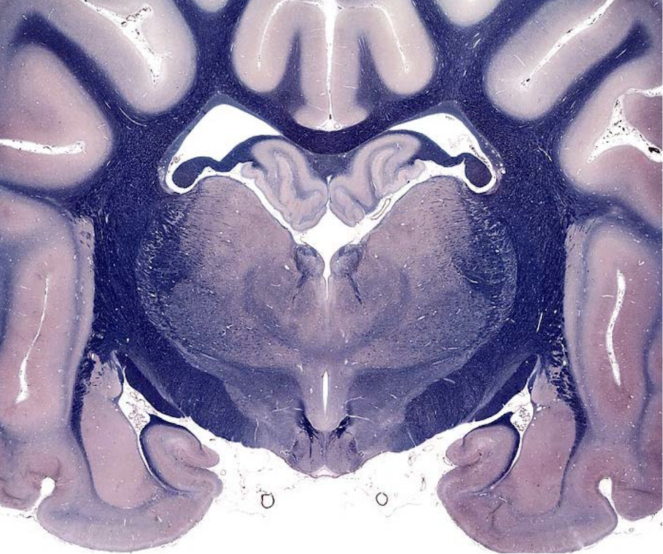 <p>what section of the brain is this?</p>