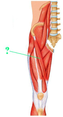 <p><span>Identify the indicated muscle.</span></p>