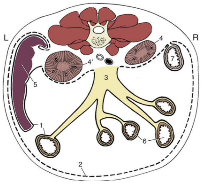 <p>What is represented by the dotted line in the image of the peritoneal cavity?</p>