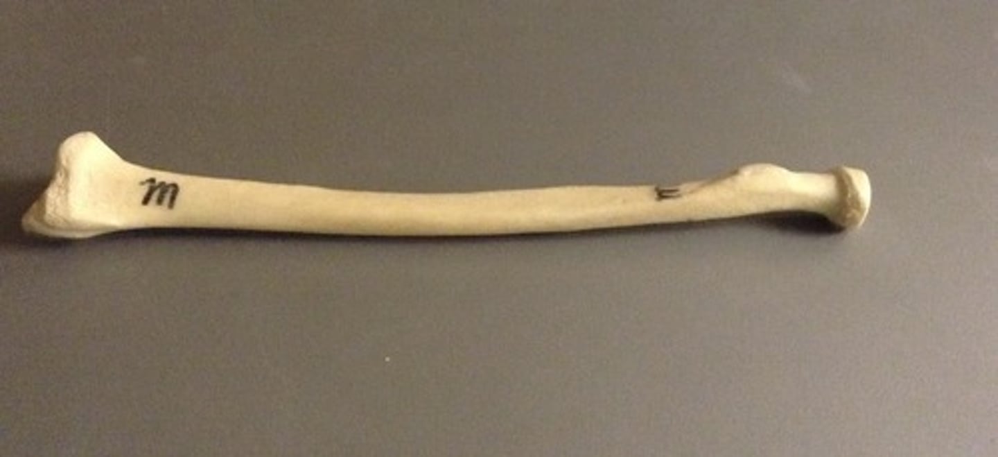 <p>ID bone</p>