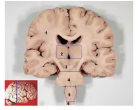 <p>Number 1 represents? </p><p>a. cerebrum</p><p>b. cerebral cortex</p><p>c. white matter</p><p>d. lateral ventricles</p>