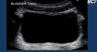 <p>-black</p><p>-fluid filled (blood urine, serous cyst)</p>
