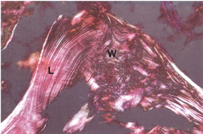 <p>Laminar bone is mature bone</p><p>Woven bone is immature</p>