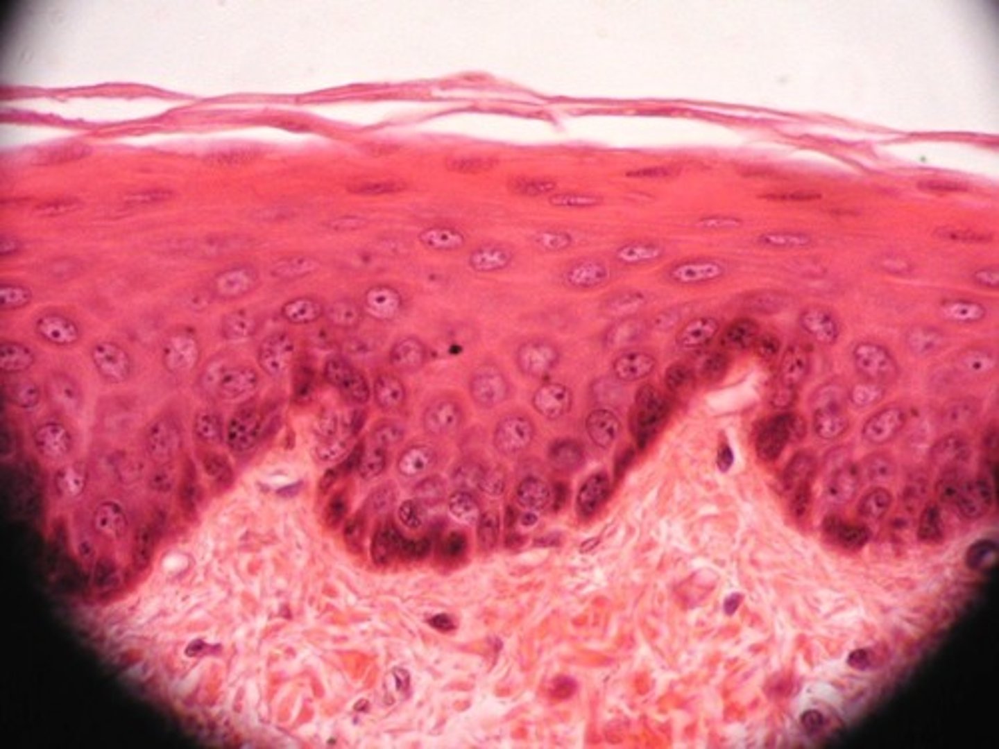 <p>Stratified squamous epithelium</p>