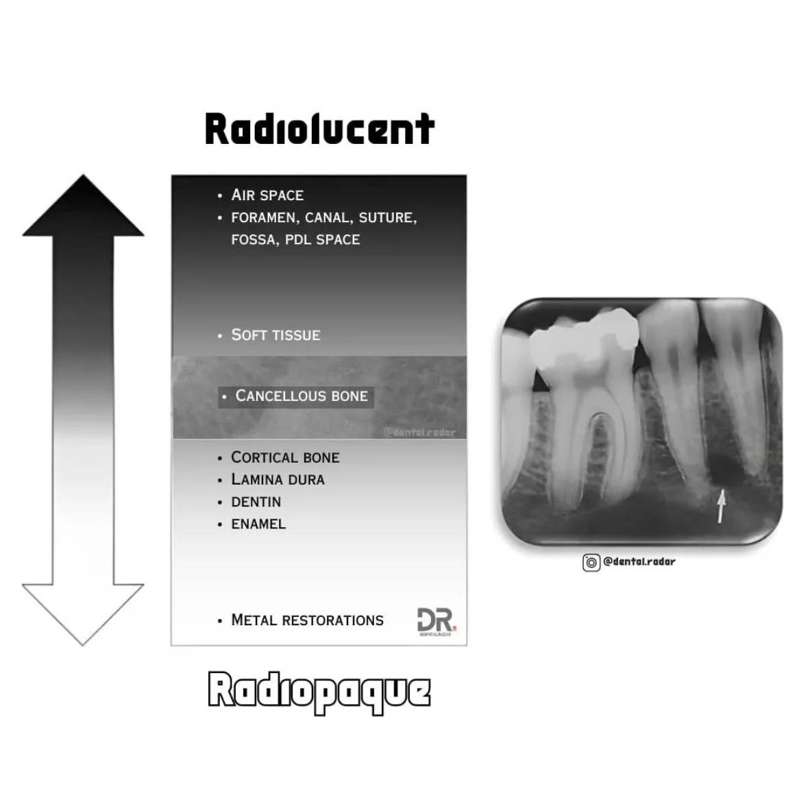 <p>Radiopaque structures appear white or light on a radiograph because it absorbs or resists the passage of the xray beam. </p><ul><li><p>ex. enamel, dentin, bone, hard or thick tissues, maxillary sinus </p></li></ul><p></p>