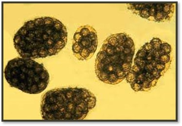 <p>Flea tapeworm egg (nerd cluster)</p>