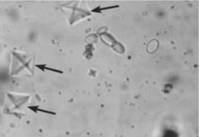 <p>What do you see in this image? What can it indicate?</p>