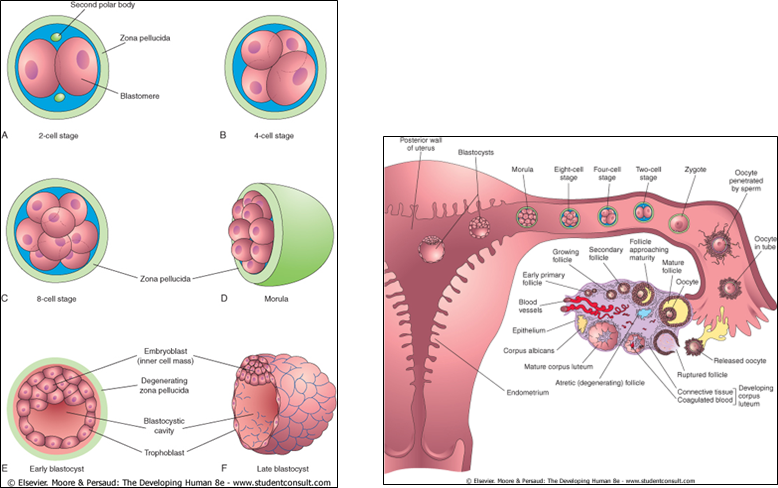 <p>The <strong>morula</strong> is a <strong>solid mass of 16–32 blastomeres</strong>, the typical stage that <strong>enters the uterus</strong>. It is still surrounded by the <strong>zona pellucida</strong>.</p>