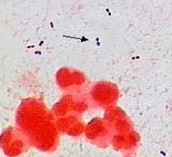 <p>What Bacterial Arrangement?</p>