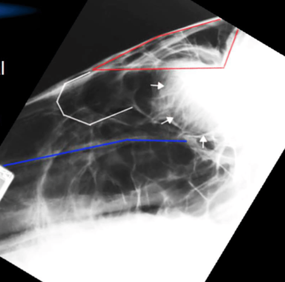 <p>What is the blue line? What is w/in this structure</p>