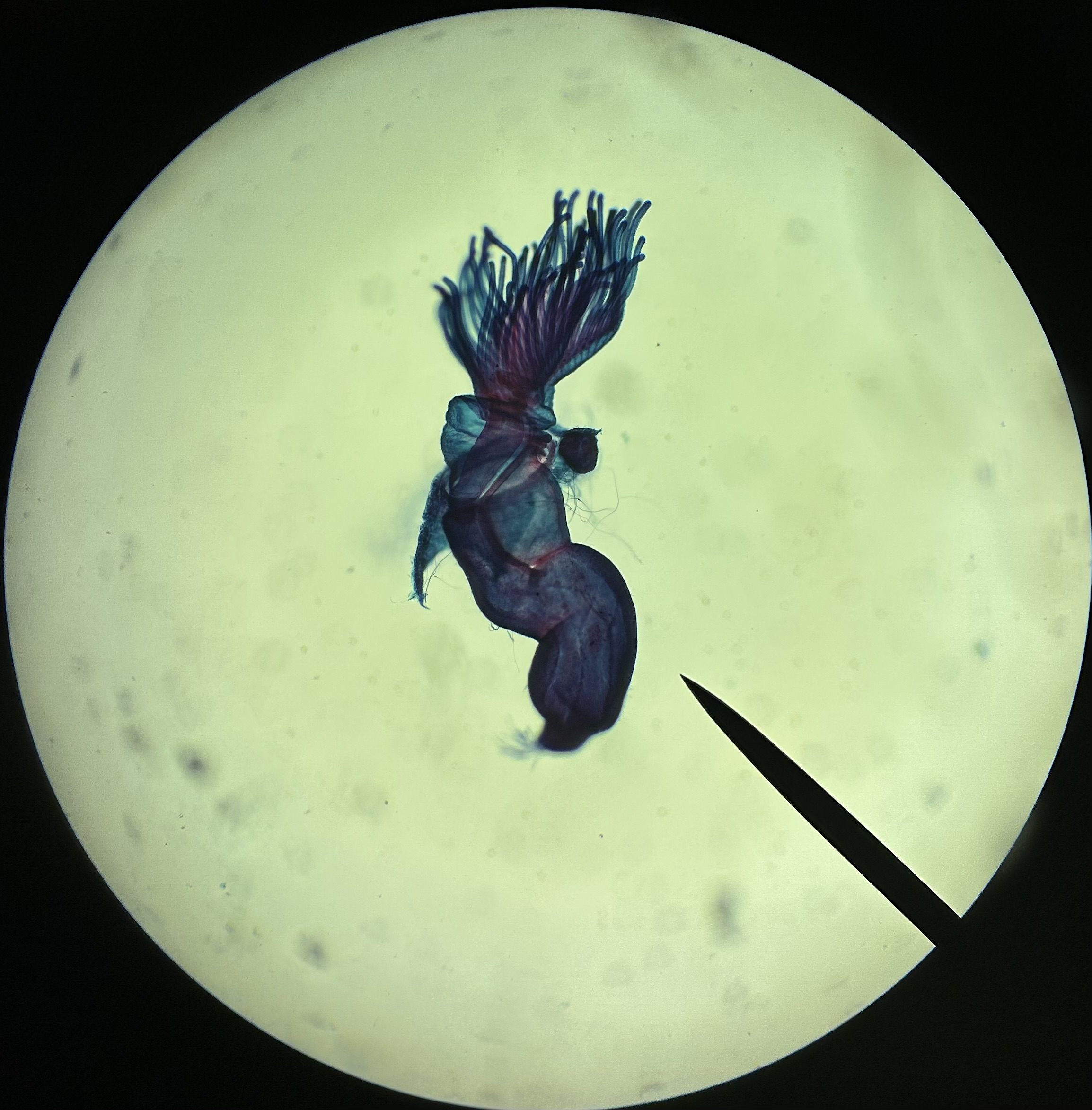 <p>Identify the organism and the Phylum it belongs to</p>
