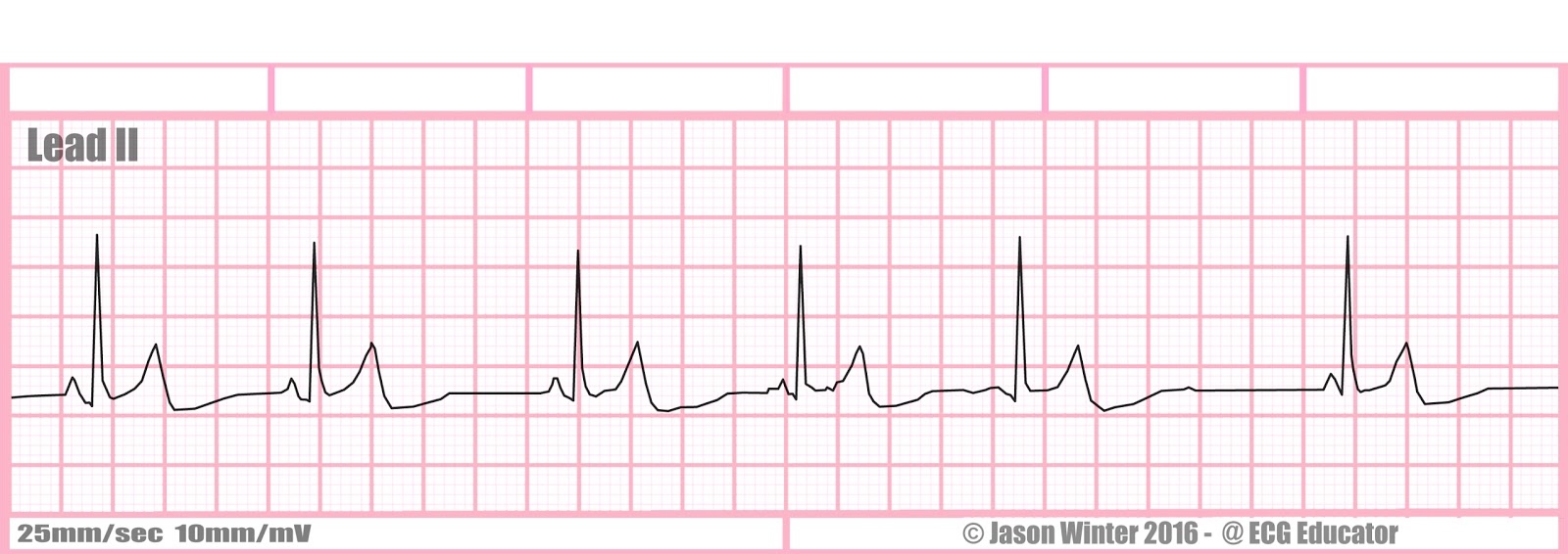 <p>What is this rhythm?</p>