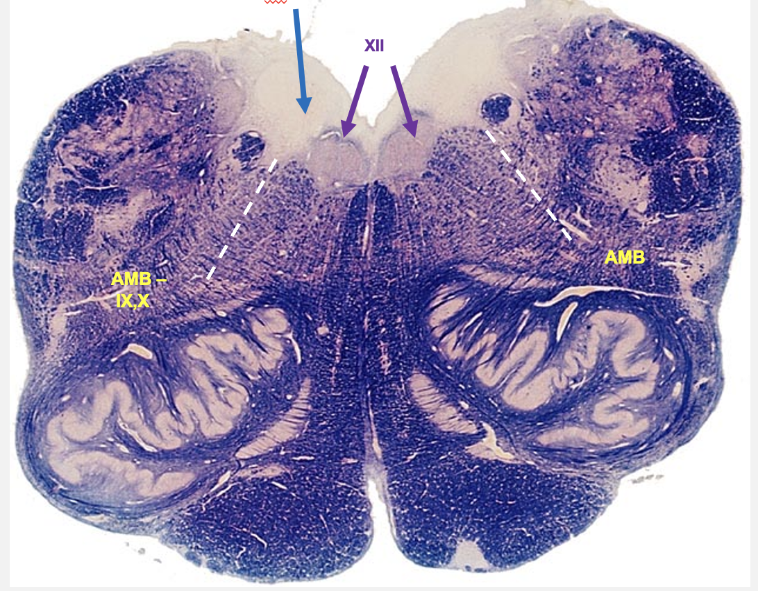 <p>nuceli seen on dorsal rostral medulla:&nbsp;</p>